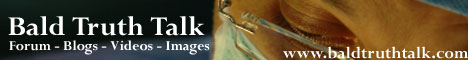 Hair Loss and Hair Transplant Forum