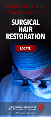 hair transplant surgeons